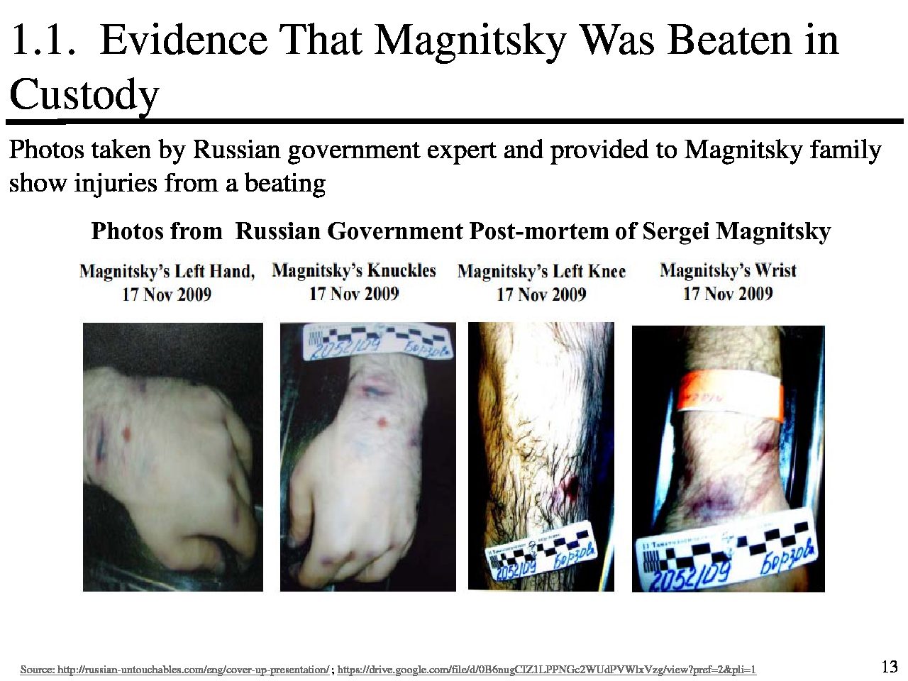 Browder shows wrist and knee bruises to prove Magnitsky beaten